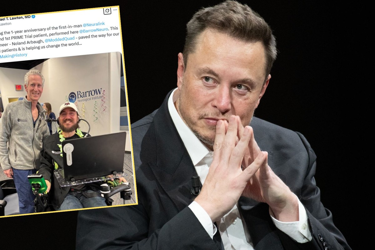 Ma w mózgu chip od Elona Muska. „Pokonuję moich przyjaciół w grach”