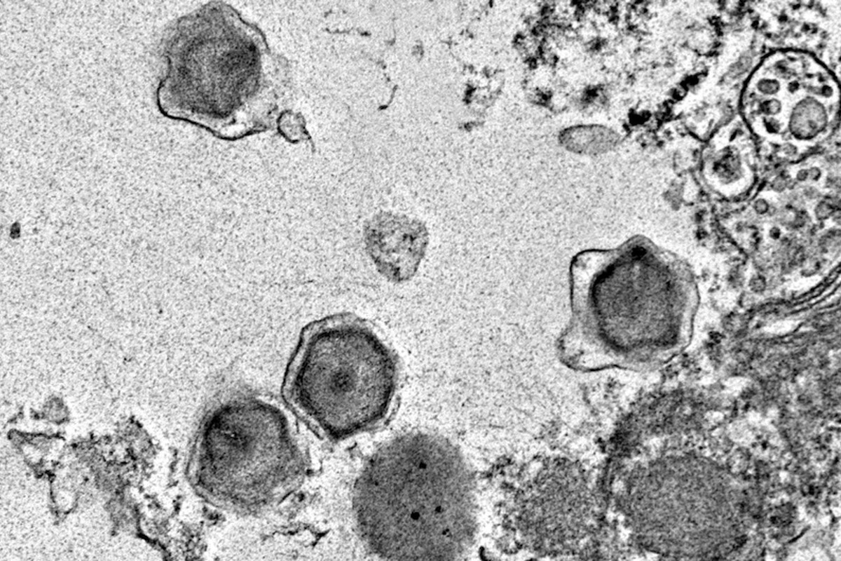 Naukowcy odkryli w oceanach setki gigantycznych wirusów. „To duże zagrożenie”